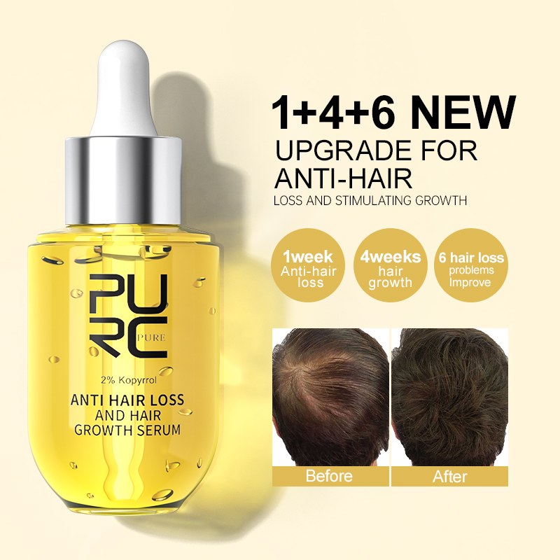 Epidermal Growth Factor - PURC Hair Growth Serum for Men
