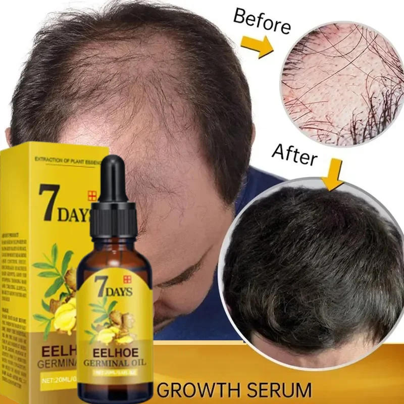 Epidermal Growth Factor - 7 Day Fast Hair Growth Oil