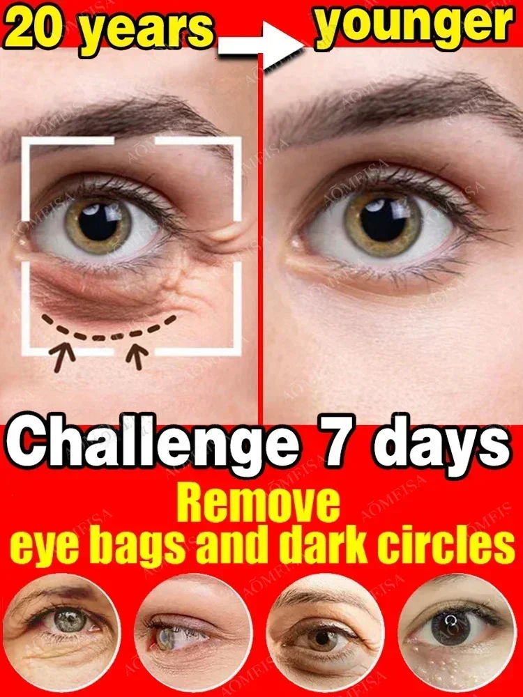 Oligopeptide Wrinkle - New 7 Day Tighten Wrinkles Eye