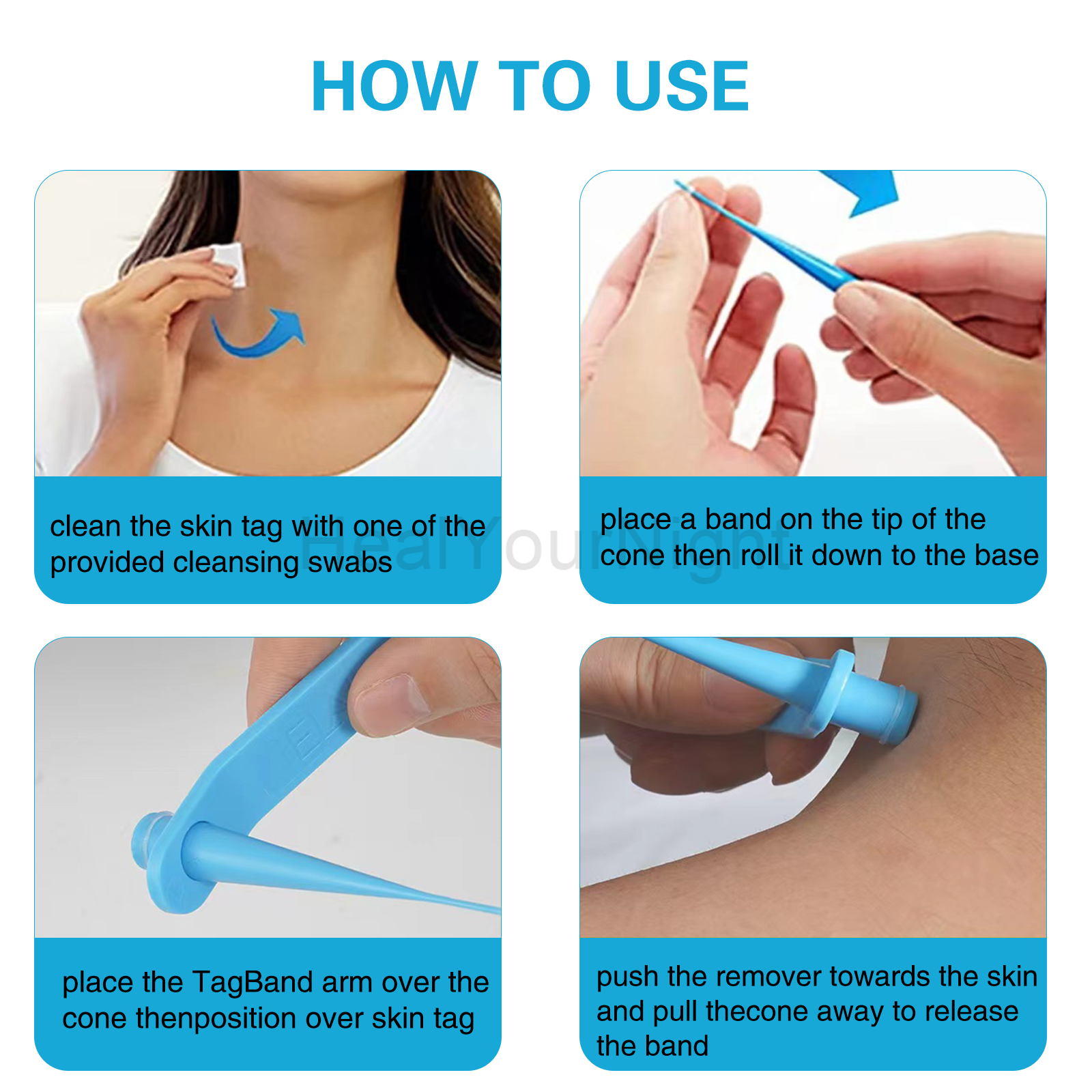 3-IN-1 Auto Skin Tag Removal K - Luxury Skincare Acne recensie en prijs