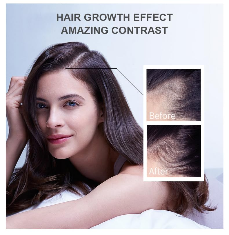 Hair Growth Oil Ginger Biotin  - Epidermal Growth Factor recensie en prijs