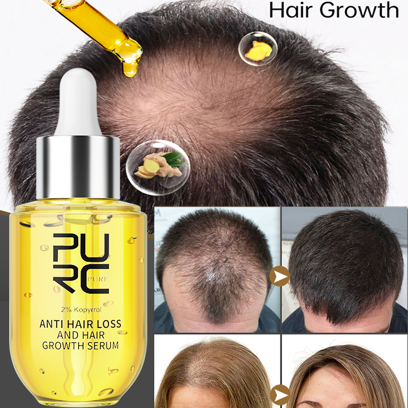 PURC Hair Growth Serum for Men - Epidermal Growth Factor recensie en prijs