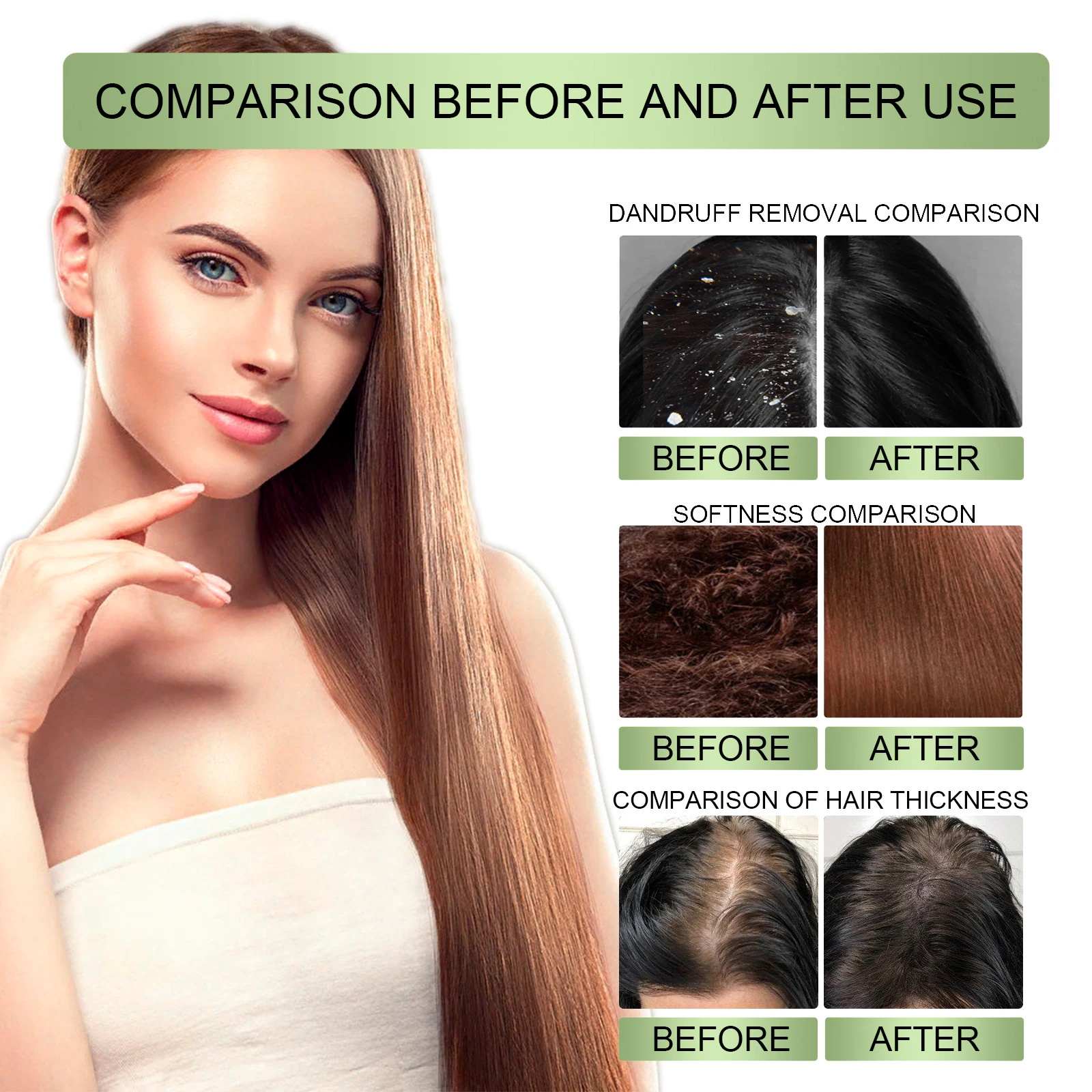 Fast Hair Growth Serum Spray A - Epidermal Growth Factor recensie en prijs