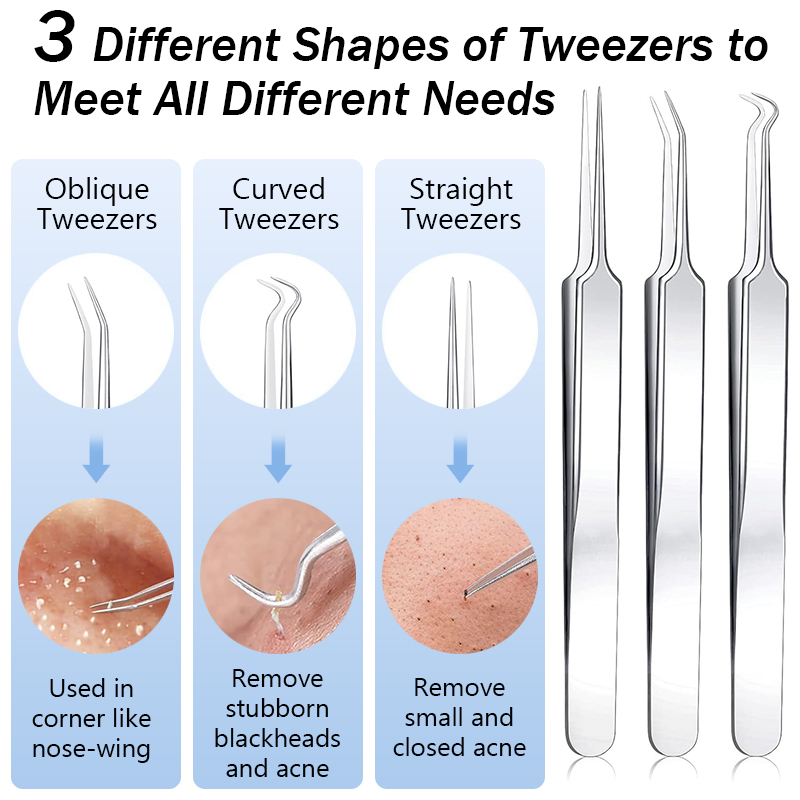 Stainless Steel Acne Blackhead - Luxury Skincare Acne recensie en prijs