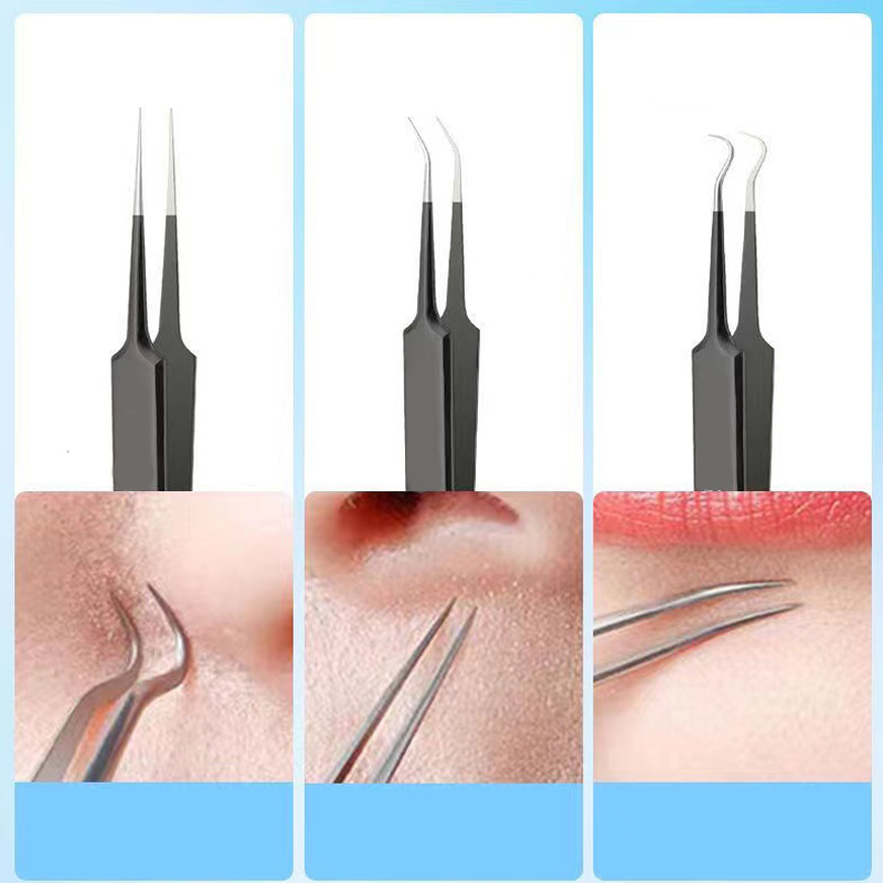 4/6PCS Face Cleaning Kit Pimpl - Luxury Skincare Acne recensie en prijs