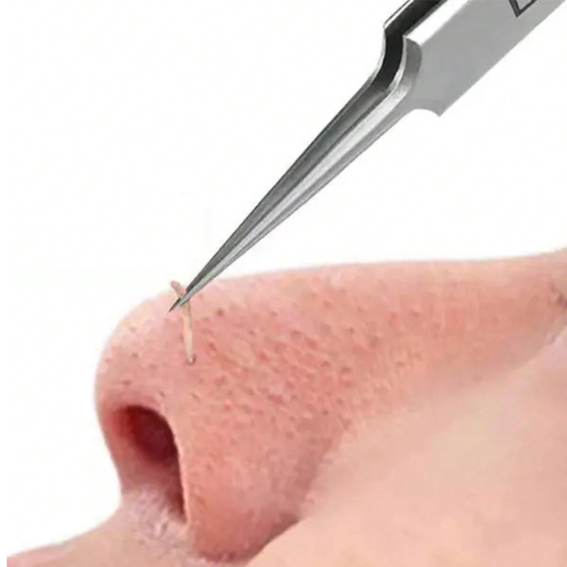 4/6PCS Face Cleaning Kit Pimpl - Luxury Skincare Acne recensie en prijs