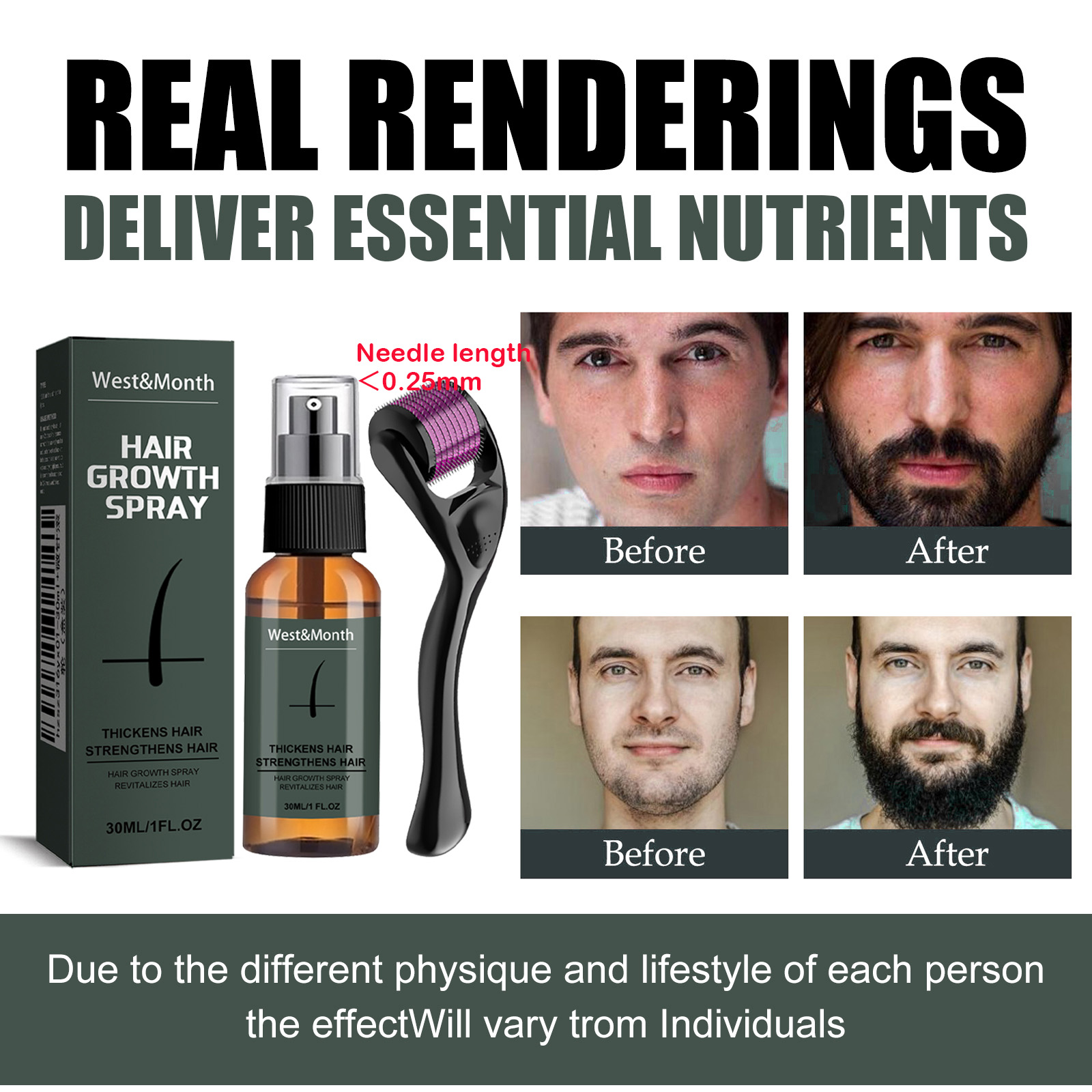 Men's Beard Spray Kit with Mic - Epidermal Growth Factor recensie en prijs