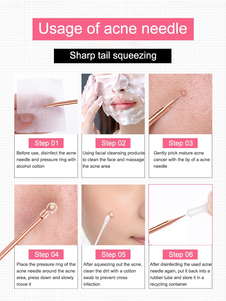 Blackhead Remover Pimple Comed - Luxury Skincare Acne recensie en prijs