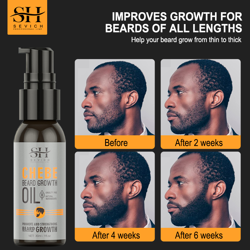 Sevich Men Beard Growth Essent - Epidermal Growth Factor recensie en prijs