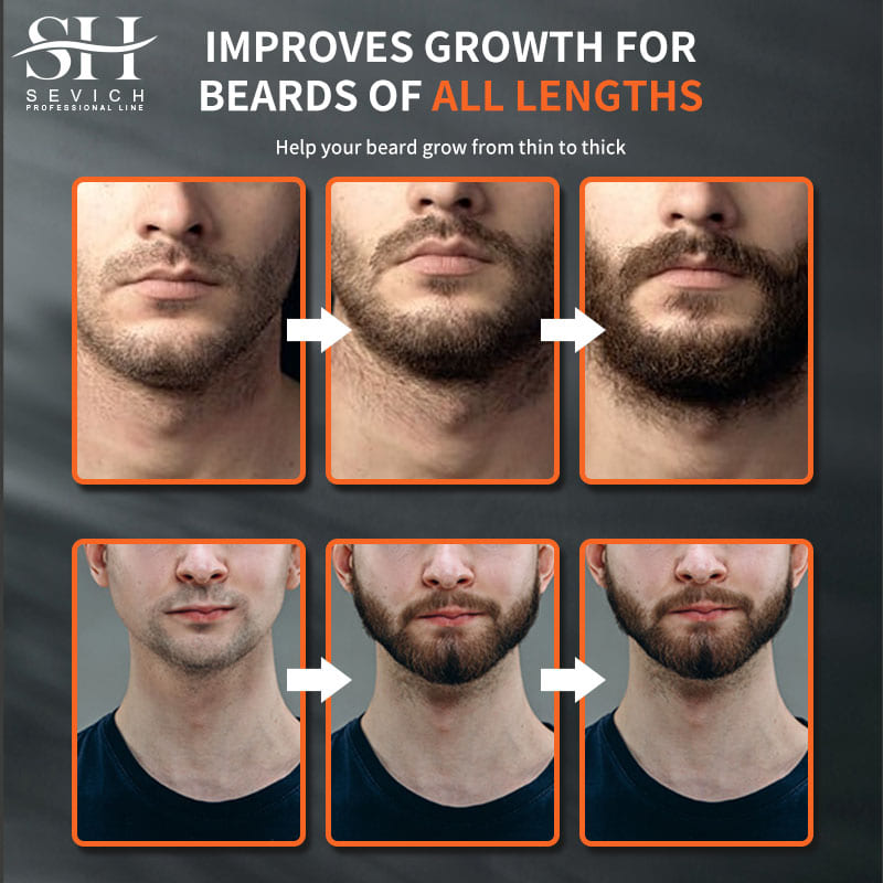 Sevich Men Beard Growth Essent - Epidermal Growth Factor recensie en prijs