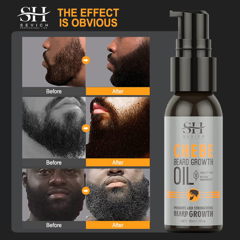 Sevich Men Beard Growth Essent - Epidermal Growth Factor recensie en prijs