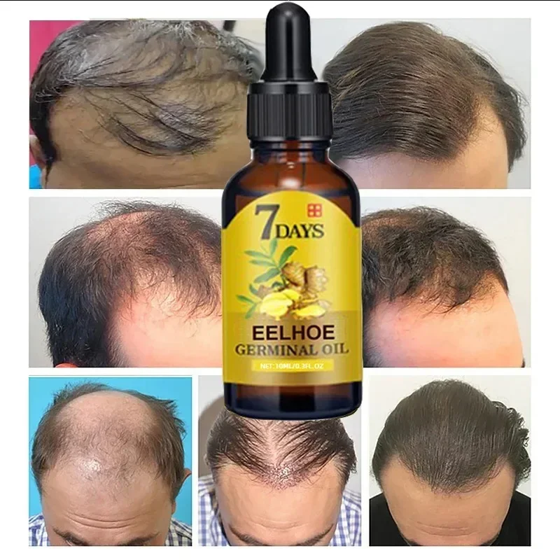 7 Day Fast Hair Growth Oil Gin - Epidermal Growth Factor recensie en prijs