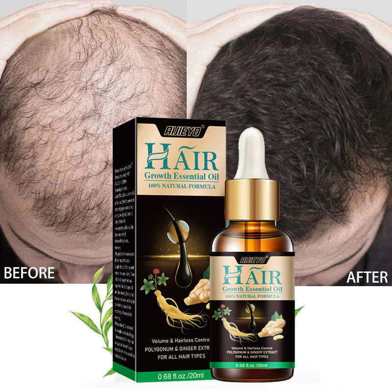 2023 Biotin Fast Hair Growth O - Epidermal Growth Factor recensie en prijs