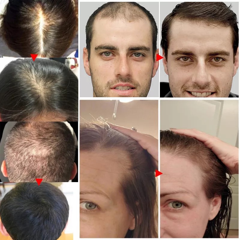 2023 Biotin Fast Hair Growth O - Epidermal Growth Factor recensie en prijs