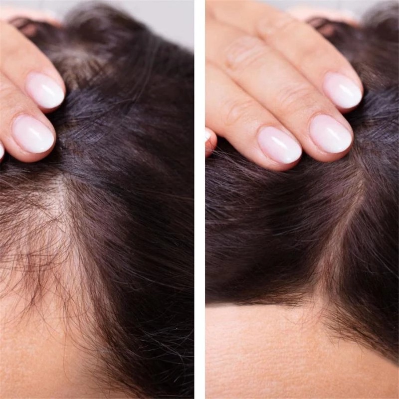2023 Biotin Fast Hair Growth O - Epidermal Growth Factor recensie en prijs