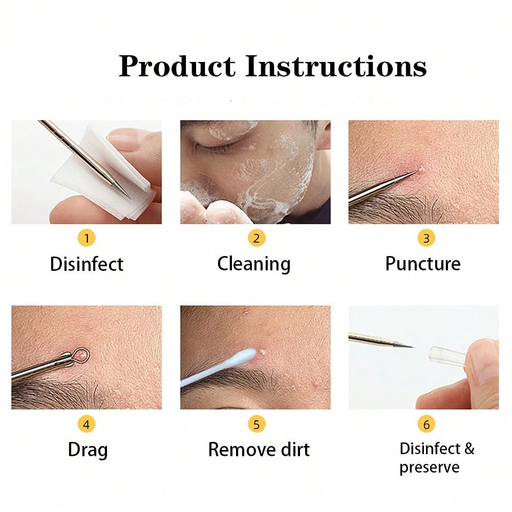 4-piece stainless steel comedo - Luxury Skincare Acne recensie en prijs