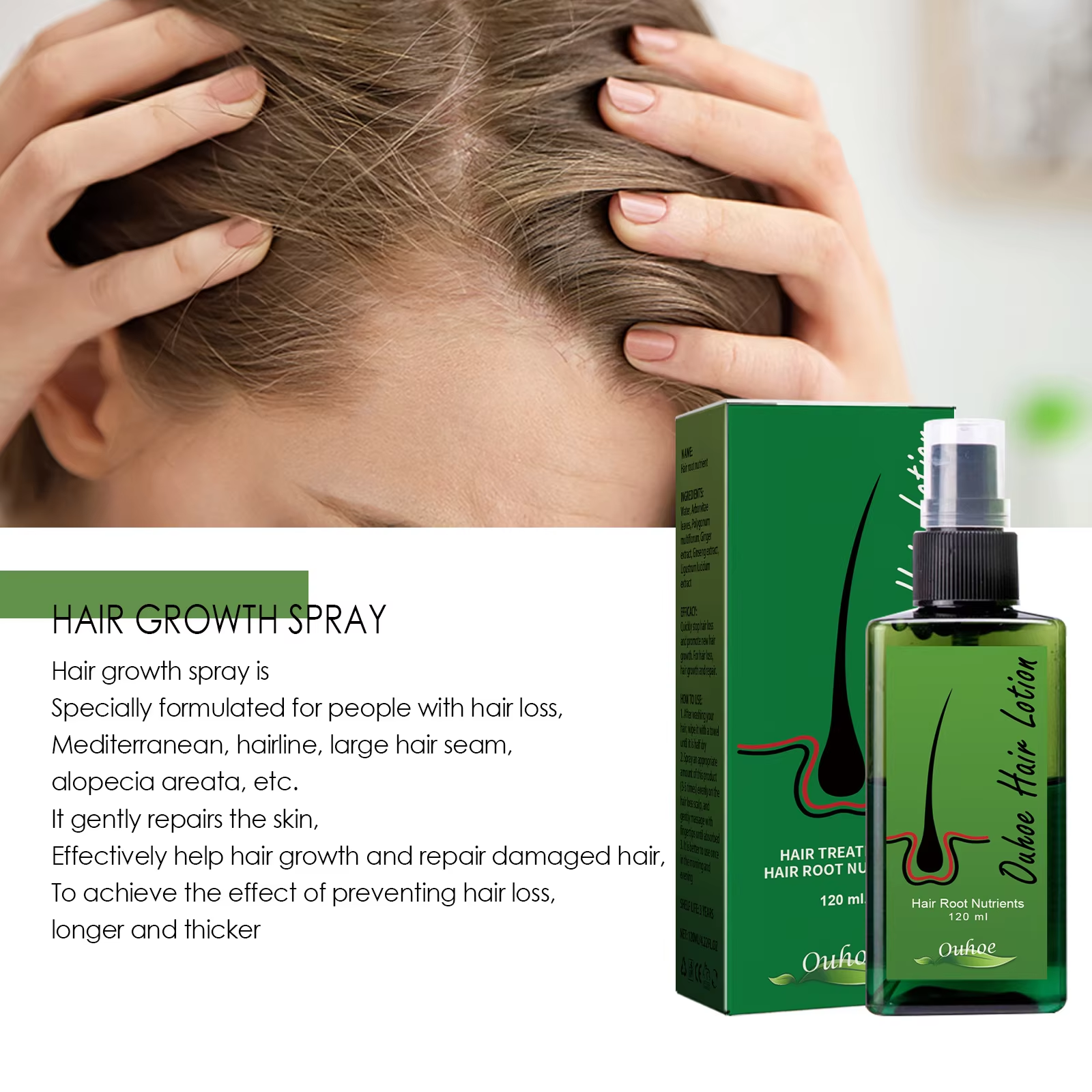 Hair Growth Spray Anti Hair Lo - Epidermal Growth Factor recensie en prijs