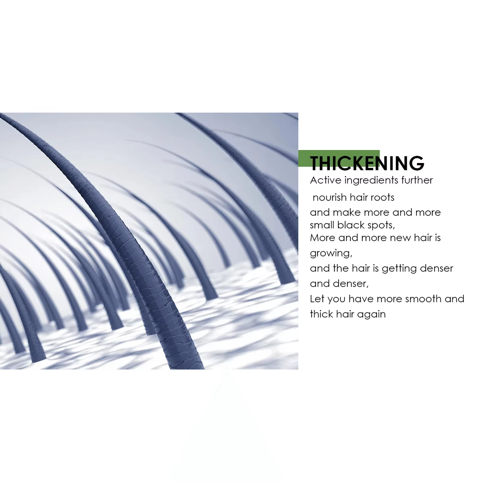 Hair Growth Spray Anti Hair Lo - Epidermal Growth Factor recensie en prijs