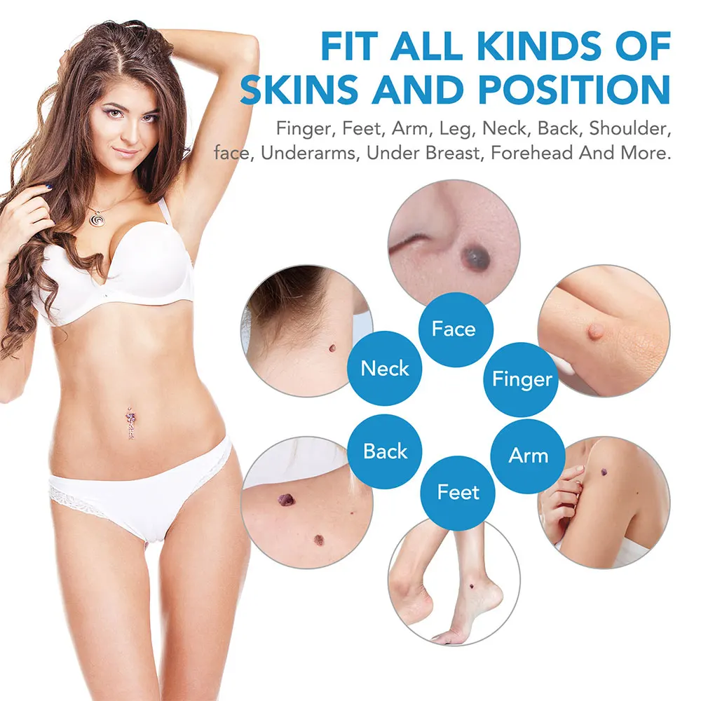 Auto Skin Tag Removal Tool Kit - Luxury Skincare Acne recensie en prijs