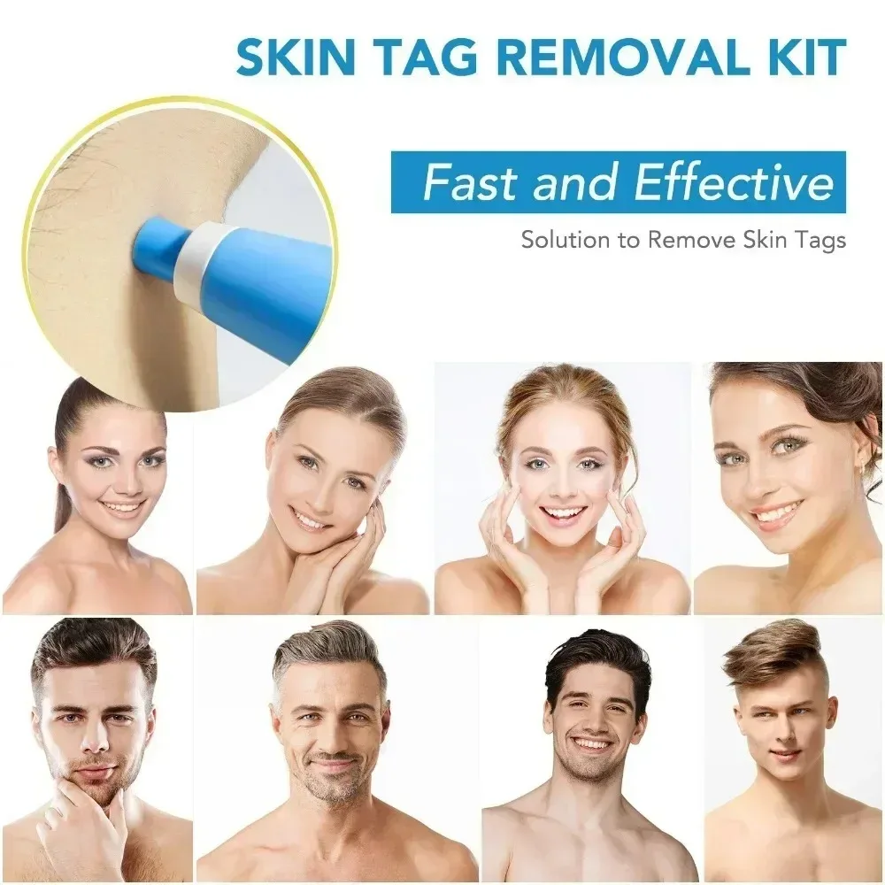Acne Remover 2 IN 1 Auto Micro - Luxury Skincare Acne recensie en prijs