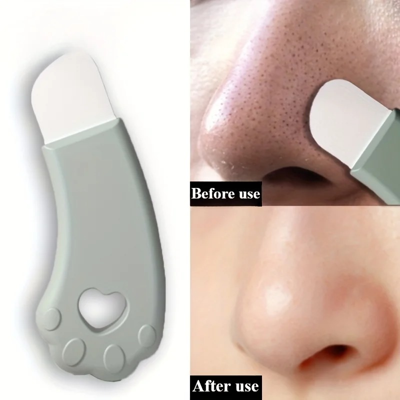 Cat Paw Blackhead Remover Tool - Luxury Skincare Acne recensie en prijs