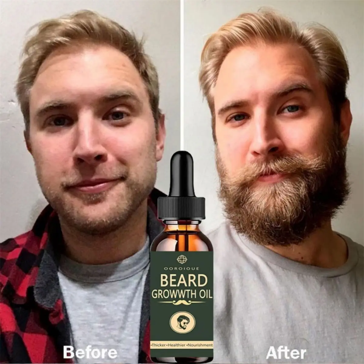 Fast Beard Growth Oil Beard Oi - Epidermal Growth Factor recensie en prijs