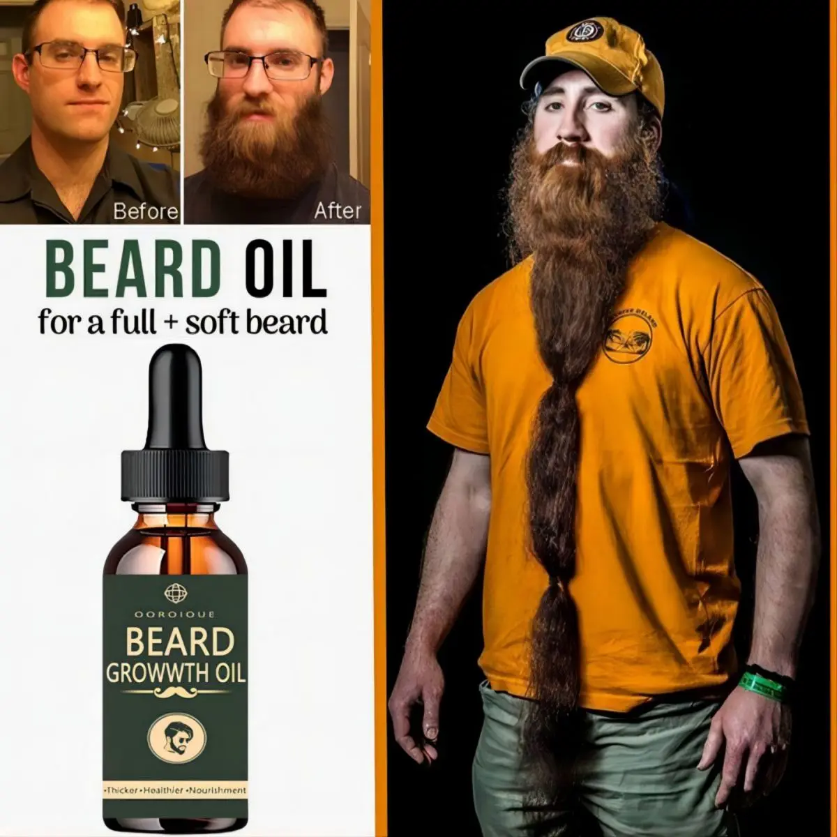 Fast Beard Growth Oil Beard Oi - Epidermal Growth Factor recensie en prijs