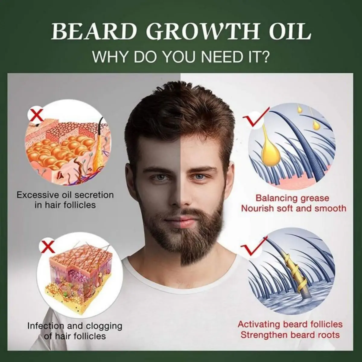 Fast Beard Growth Oil Beard Oi - Epidermal Growth Factor recensie en prijs