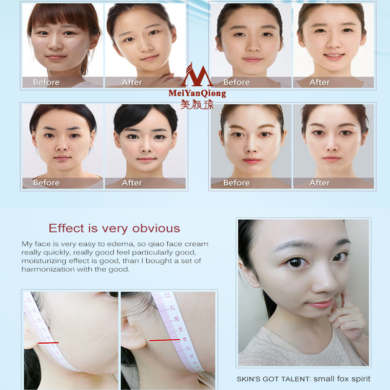 Face Lifting Shaping Skin Care - Luxury Skincare Anti Aging recensie en prijs