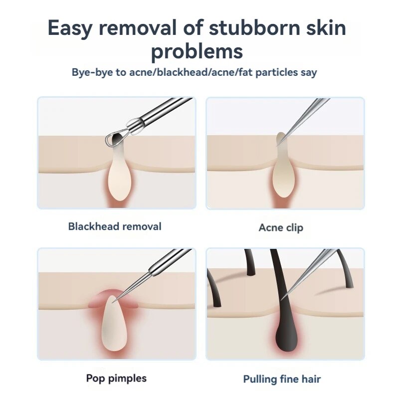 7pcs Stainless Steel Splinter  - Luxury Skincare Acne recensie en prijs