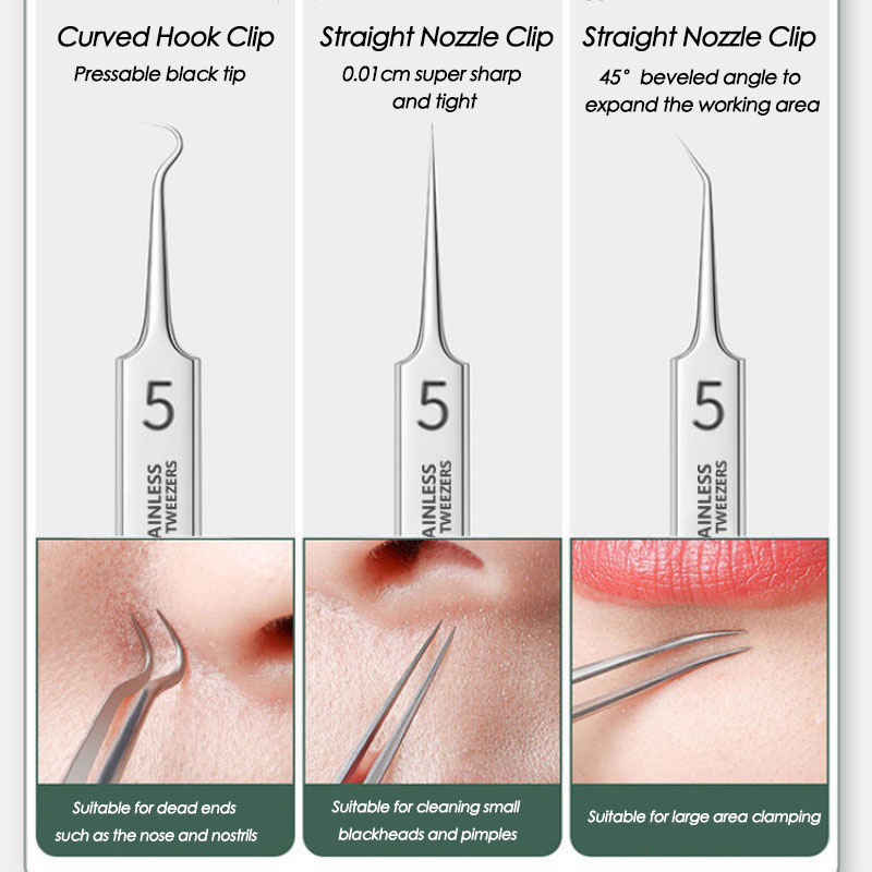 Acne Blackhead Removal Needles - Luxury Skincare Acne recensie en prijs
