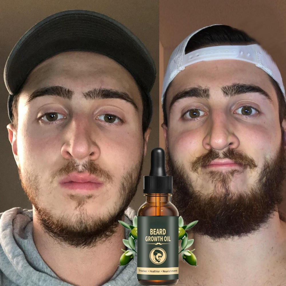 Fast Beard Growth Oil Beard Oi - Epidermal Growth Factor recensie en prijs